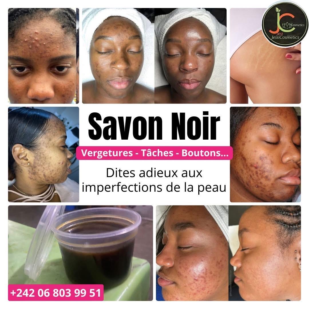 Savon noir blancs  - Beauté - Jessi Cosmetics